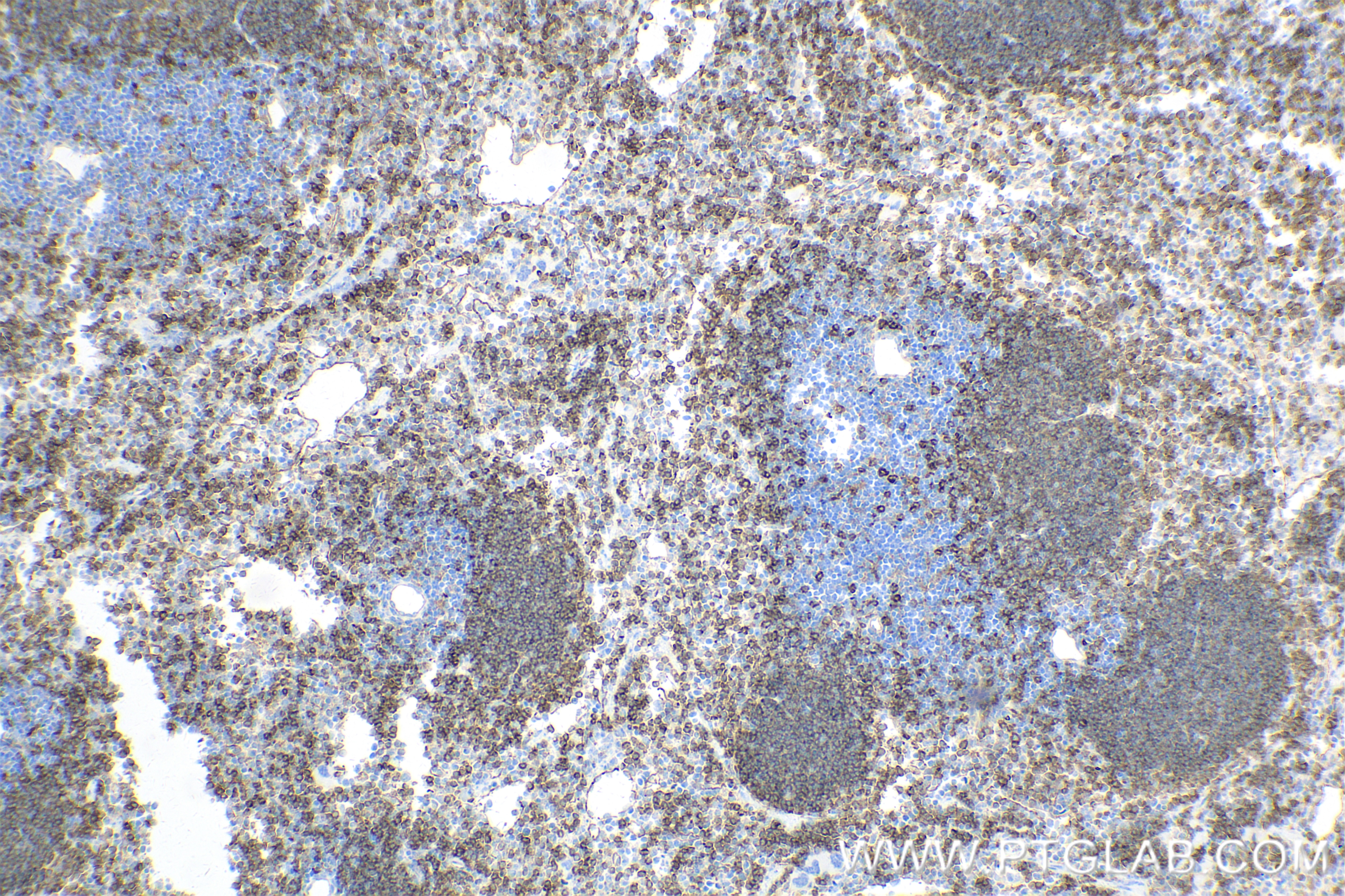 Immunohistochemistry (IHC) staining of mouse spleen tissue using SWAP70 Recombinant antibody (83646-6-RR)