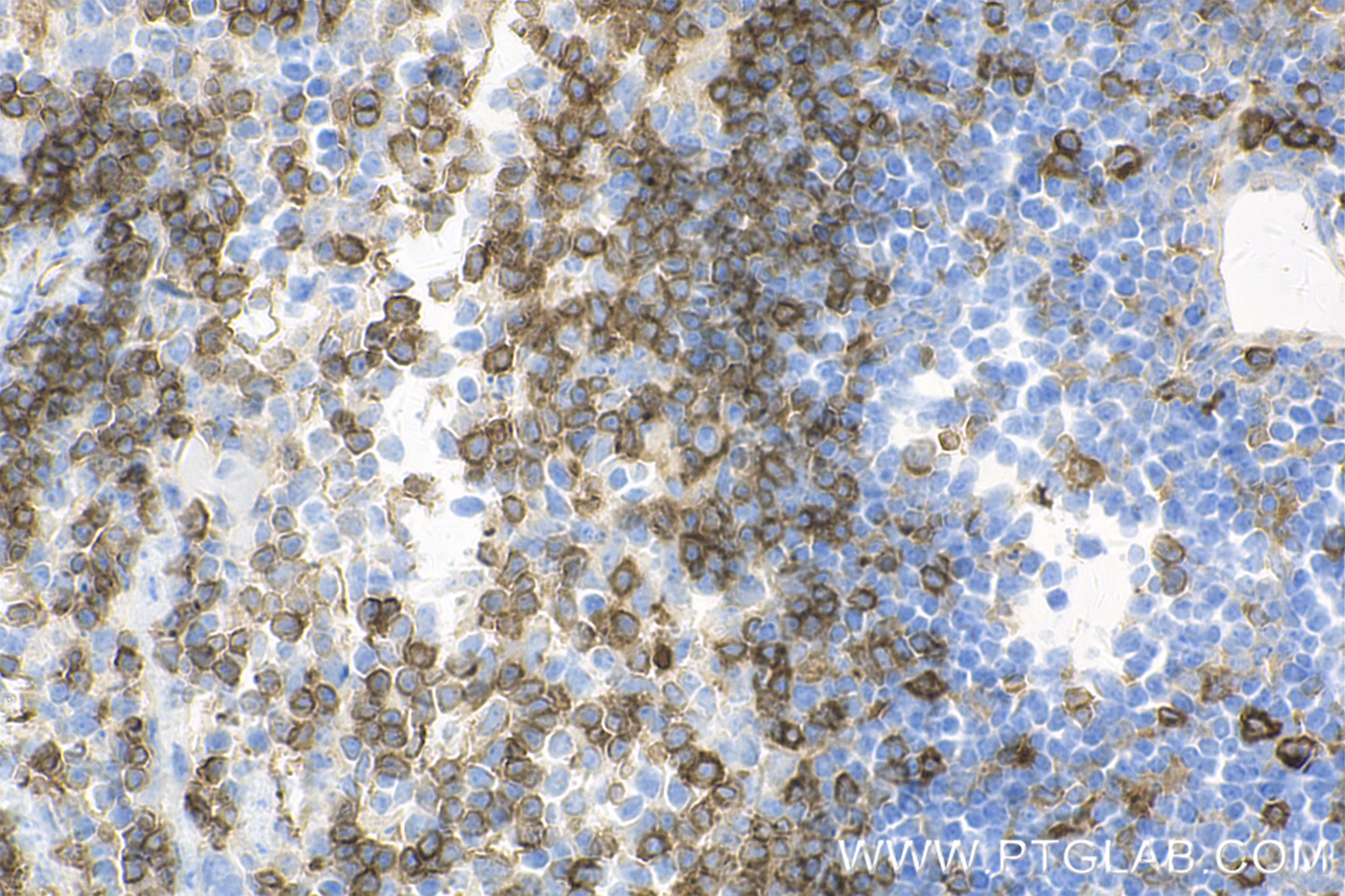 Immunohistochemistry (IHC) staining of mouse spleen tissue using SWAP70 Recombinant antibody (83646-6-RR)