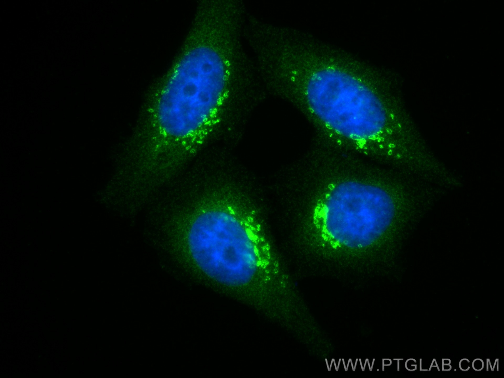 Immunofluorescence (IF) / fluorescent staining of HepG2 cells using SYAP1 Polyclonal antibody (16272-1-AP)