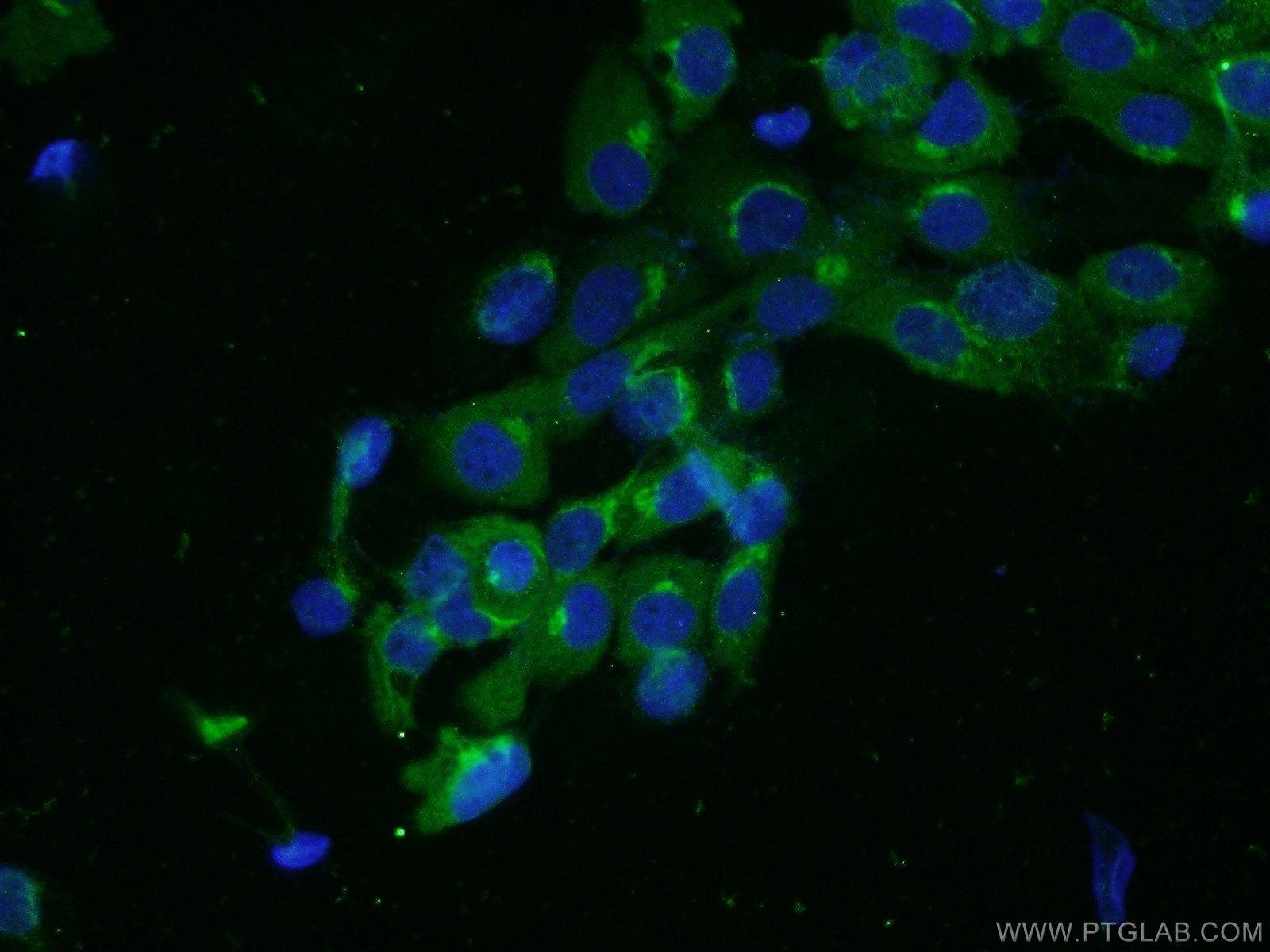 Immunofluorescence (IF) / fluorescent staining of A431 cells using SYAP1 Polyclonal antibody (16272-1-AP)