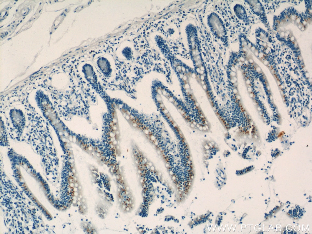 IHC staining of human small intestine using 16272-1-AP