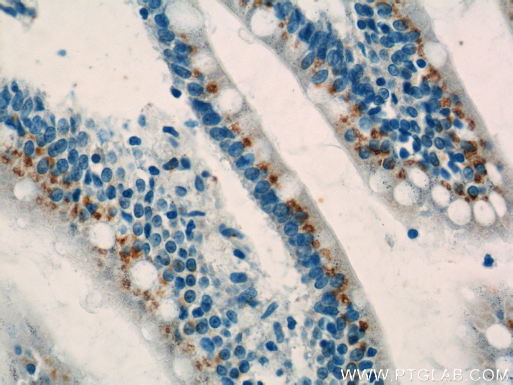 Immunohistochemistry (IHC) staining of human small intestine tissue using SYAP1 Polyclonal antibody (16272-1-AP)