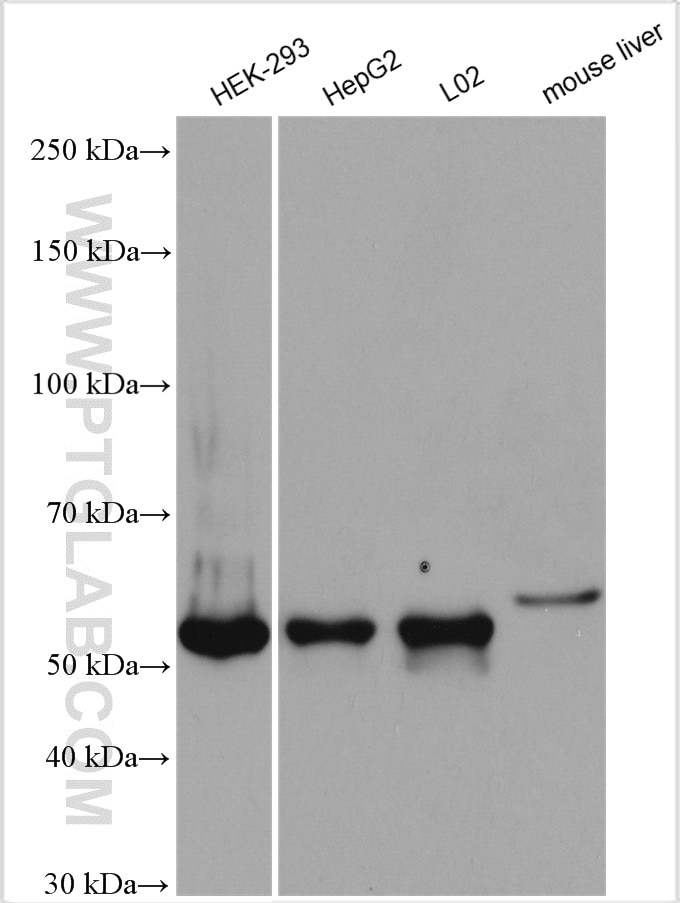 Western Blot (WB) analysis of various lysates using SYAP1 Polyclonal antibody (16272-1-AP)