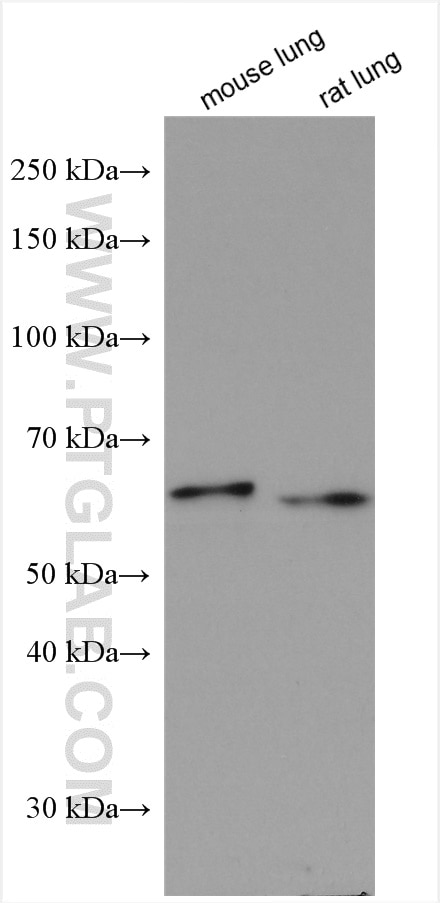 Western Blot (WB) analysis of various lysates using SYAP1 Polyclonal antibody (16272-1-AP)