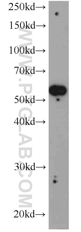 Western Blot (WB) analysis of SMMC-7721 cells using SYAP1 Polyclonal antibody (16272-1-AP)