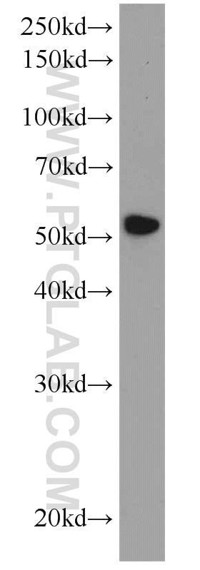 Western Blot (WB) analysis of A431 cells using SYAP1 Polyclonal antibody (16272-1-AP)