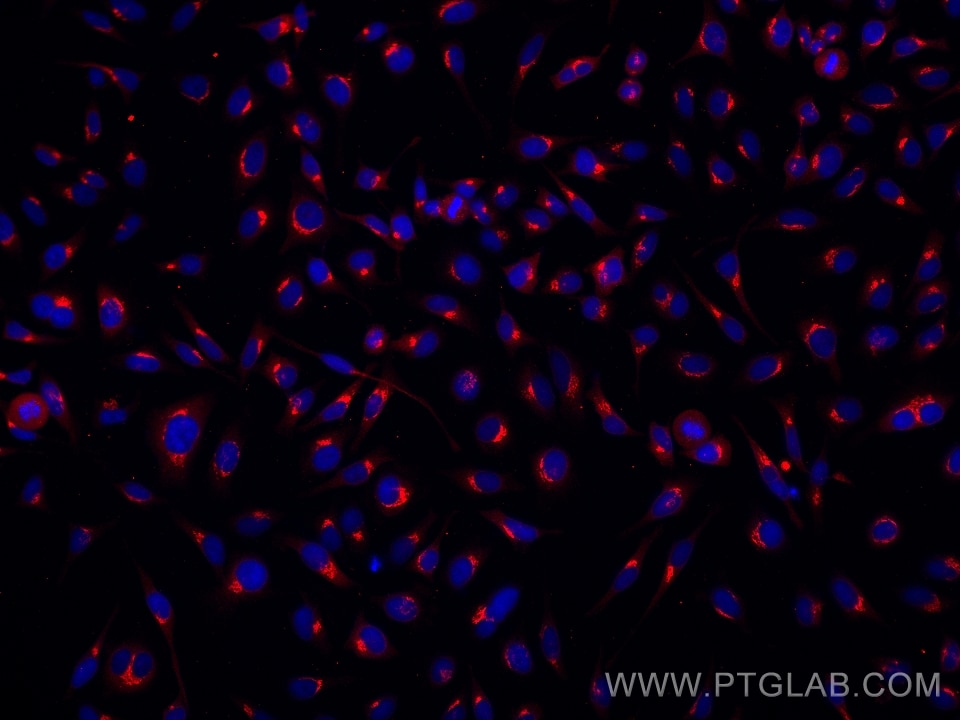 Immunofluorescence (IF) / fluorescent staining of HeLa cells using SYAP1 Monoclonal antibody (68410-1-Ig)