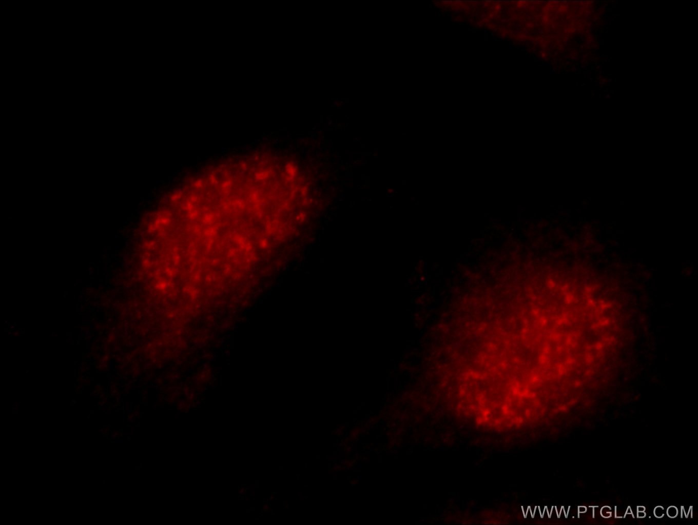 Immunofluorescence (IF) / fluorescent staining of HepG2 cells using SYCE1 Polyclonal antibody (11063-1-AP)
