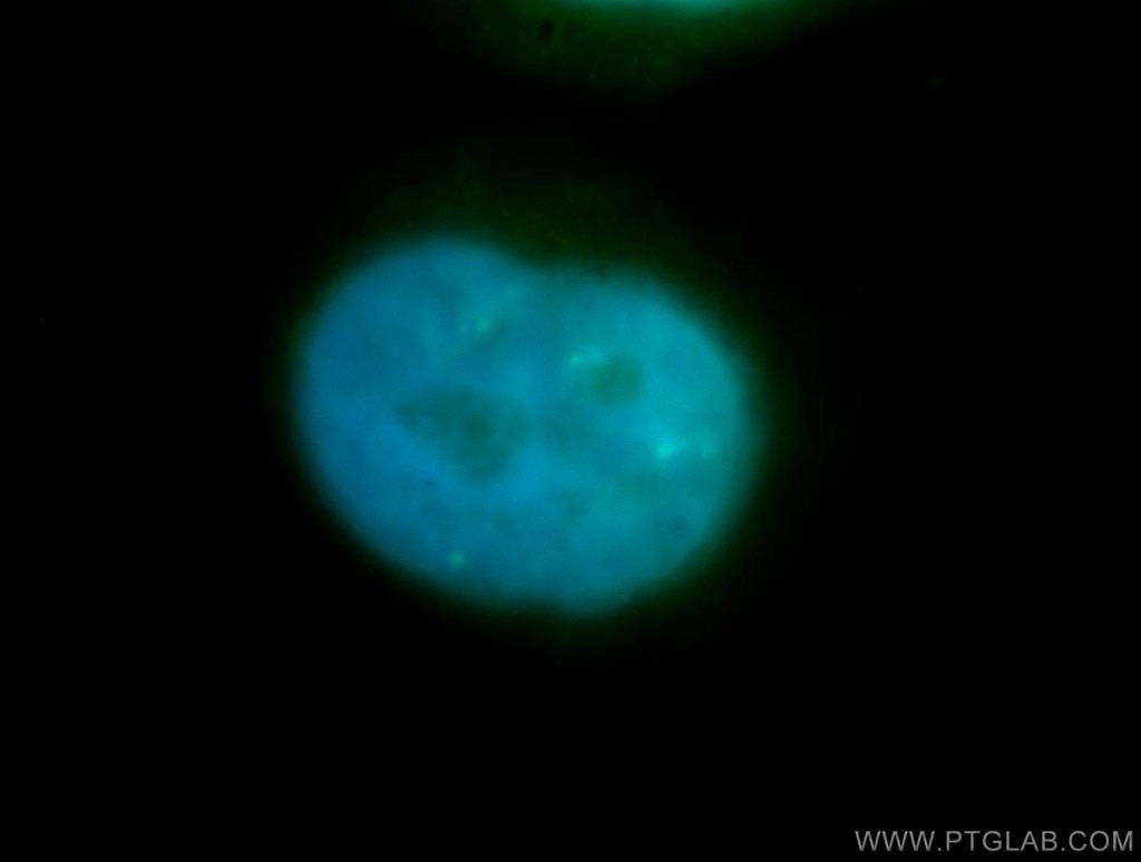 IF Staining of HepG2 using 11063-1-AP