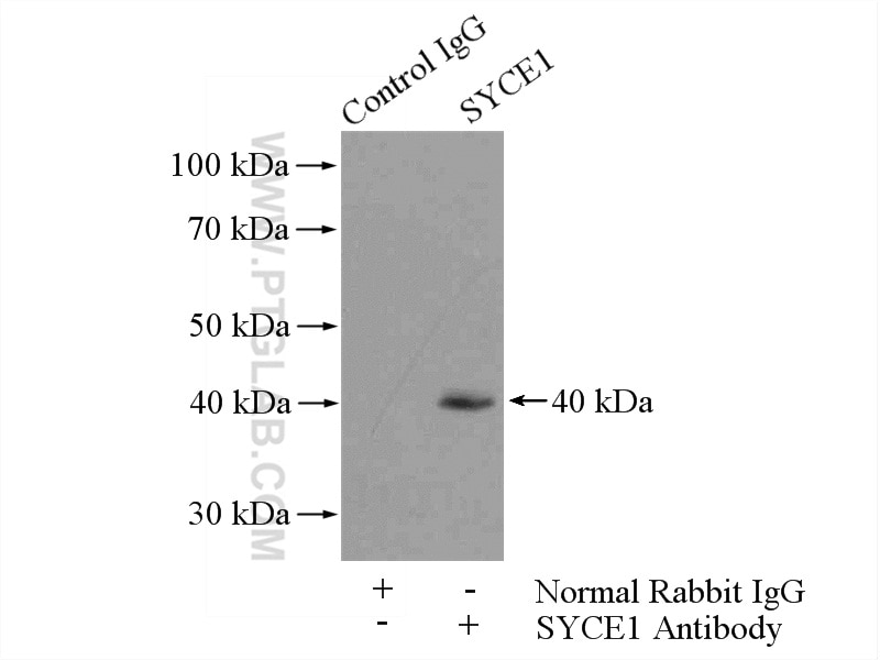 Immunoprecipitation (IP) experiment of mouse testis tissue using SYCE1 Polyclonal antibody (11063-1-AP)