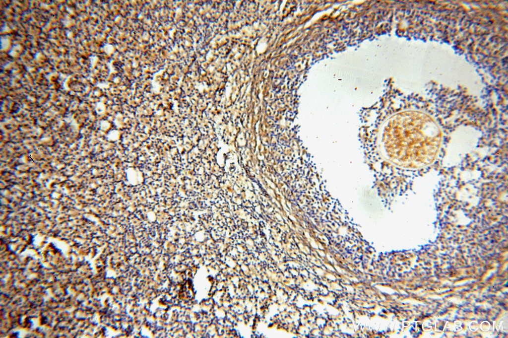 Immunohistochemistry (IHC) staining of human ovary tissue using SYCE1 Polyclonal antibody (17406-1-AP)