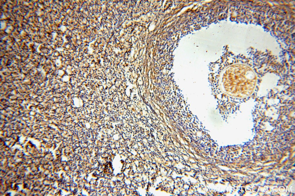 IHC staining of human ovary using 17406-1-AP