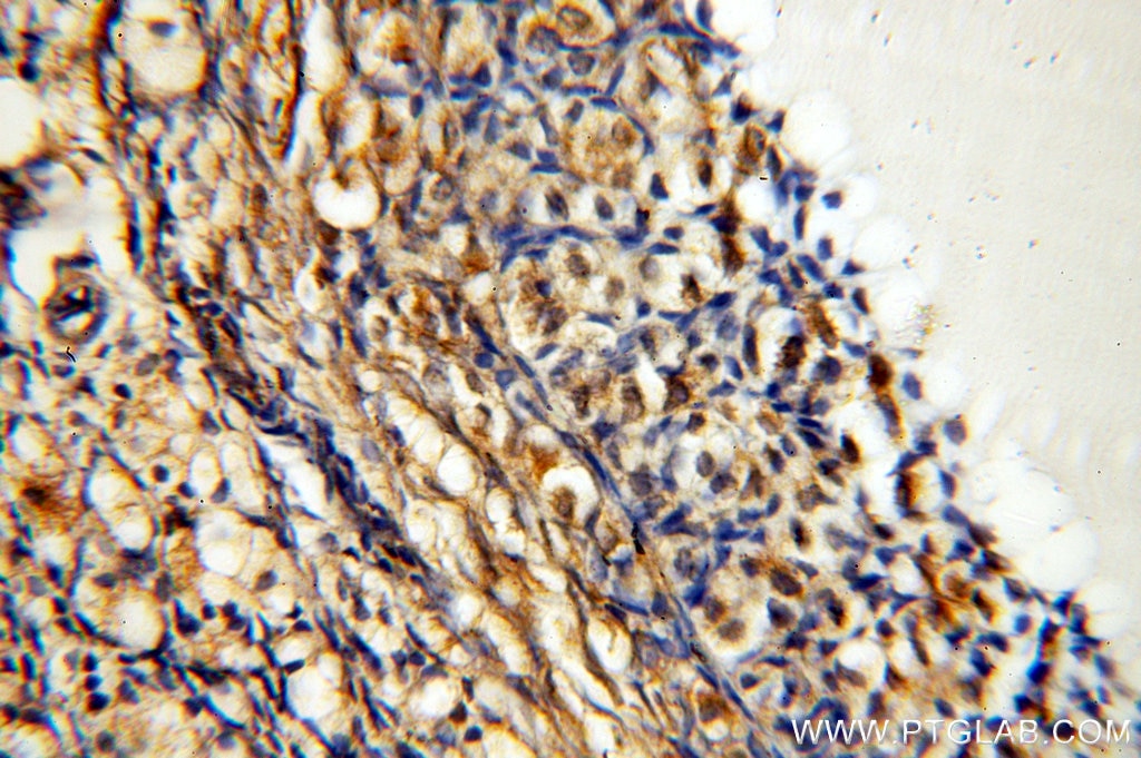Immunohistochemistry (IHC) staining of human ovary tissue using SYCE1 Polyclonal antibody (17406-1-AP)