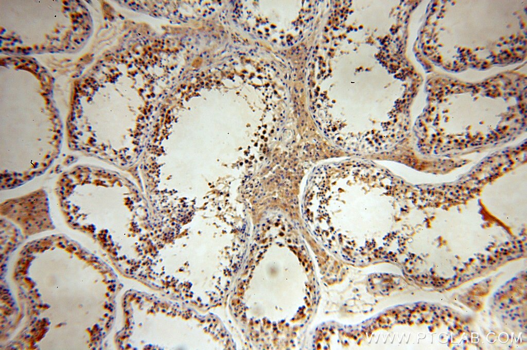 Immunohistochemistry (IHC) staining of human testis tissue using SYCE1 Polyclonal antibody (17406-1-AP)