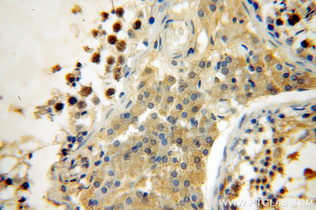 Immunohistochemistry (IHC) staining of human testis tissue using SYCE1 Polyclonal antibody (17406-1-AP)