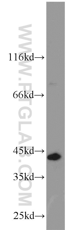 Western Blot (WB) analysis of rat testis tissue using SYCE1 Polyclonal antibody (17406-1-AP)