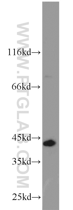 WB analysis of rat testis using 17406-1-AP