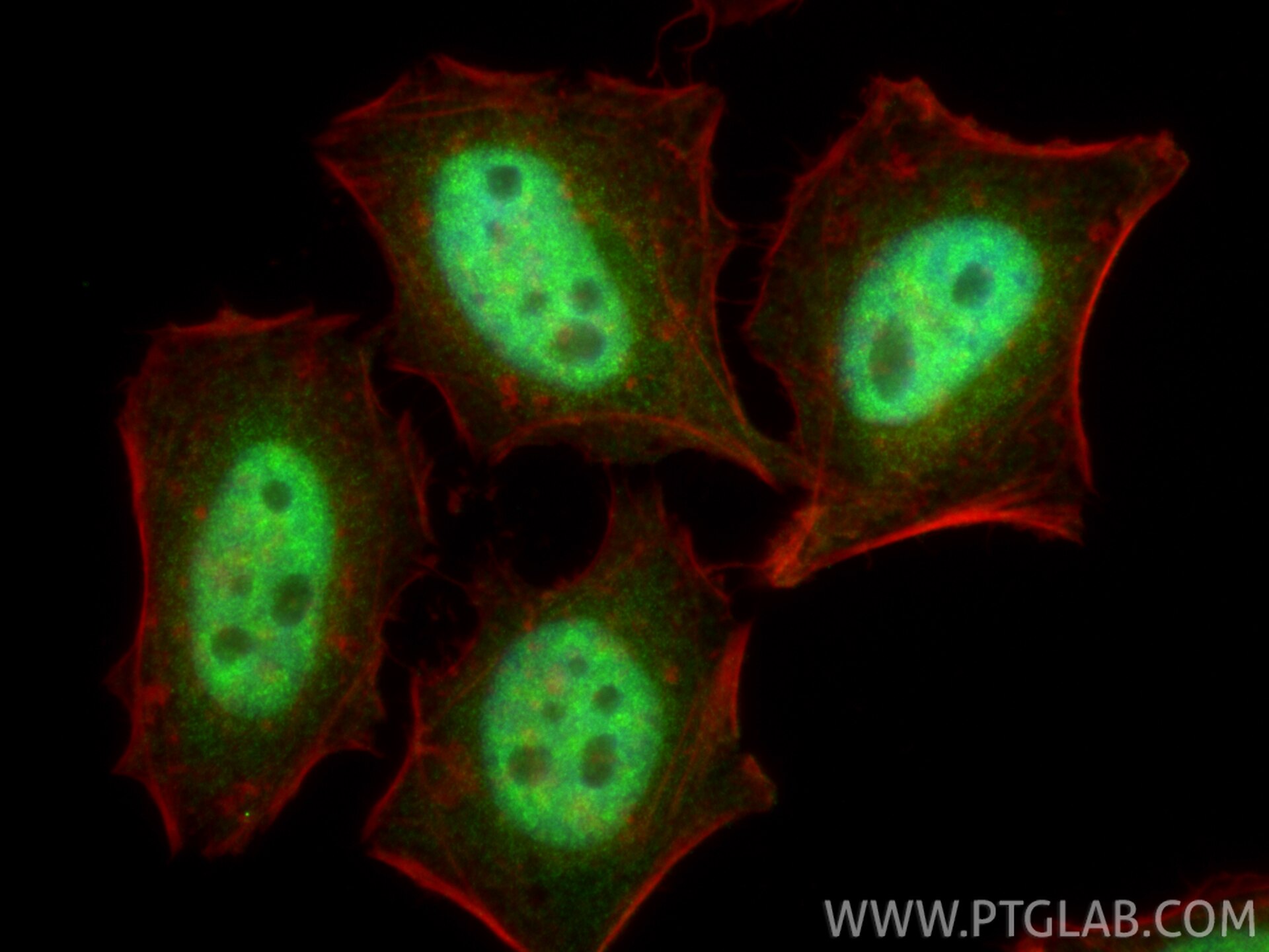 IF Staining of HeLa using 16859-1-AP Immunofluorescence (IF) / fluorescent staining of HeLa cells using SYCE2-Specific Polyclonal antibody (16859-1-AP)