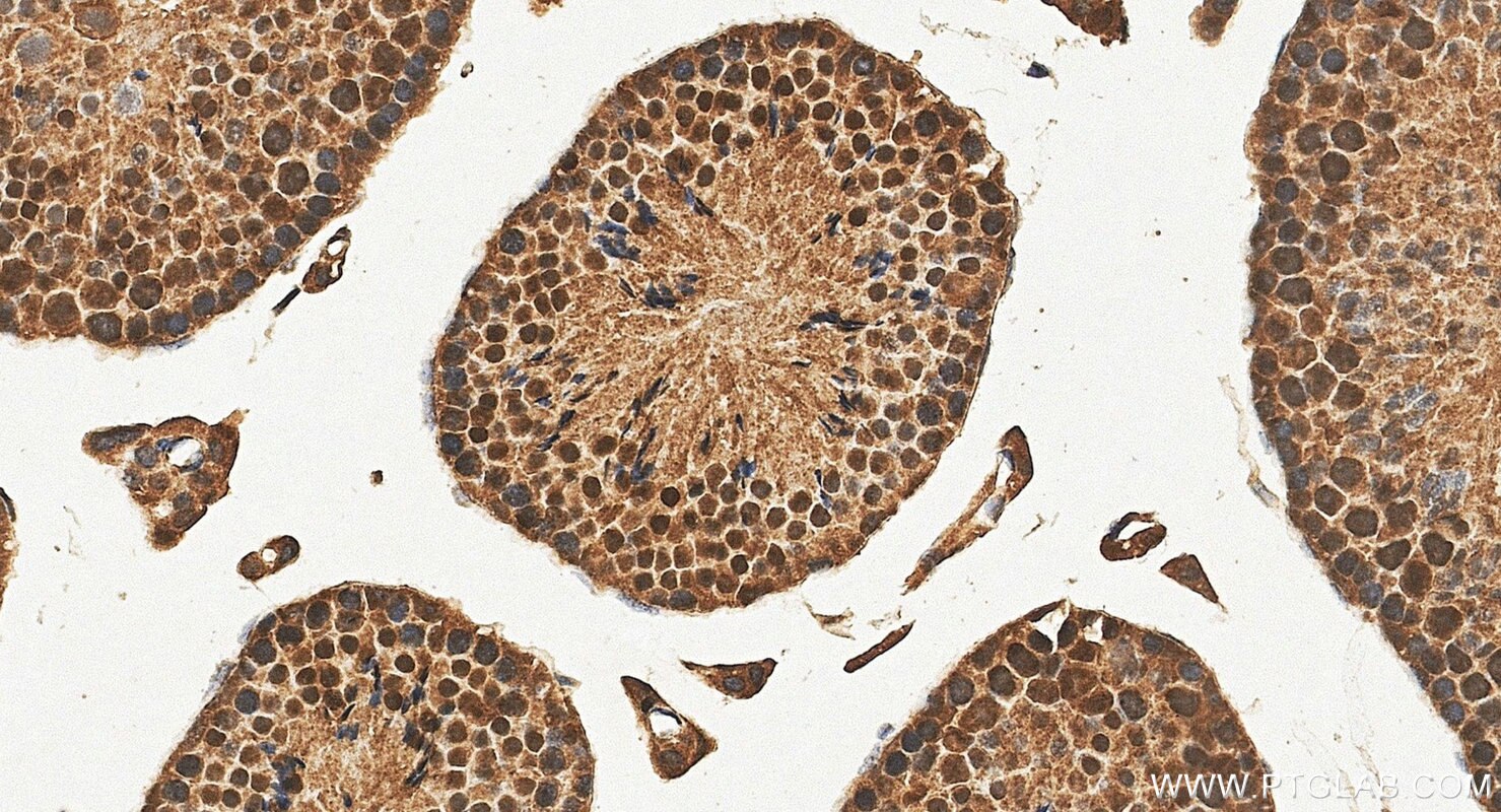 IHC staining of mouse testis using 16859-1-AP Immunohistochemistry (IHC) staining of mouse testis tissue using SYCE2-Specific Polyclonal antibody (16859-1-AP)