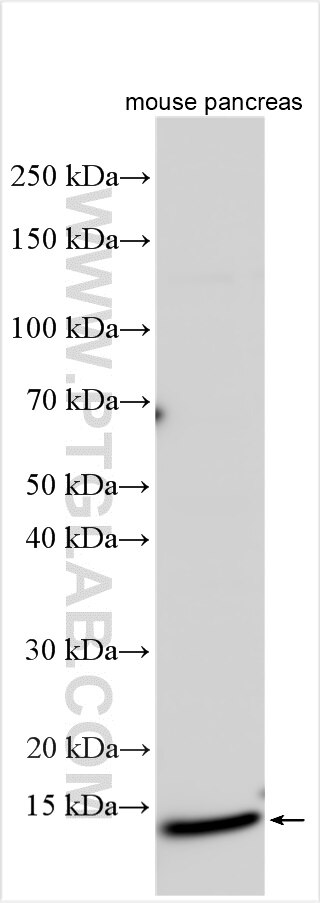 Western Blot (WB) analysis of various lysates using SYCN Polyclonal antibody (26662-1-AP)