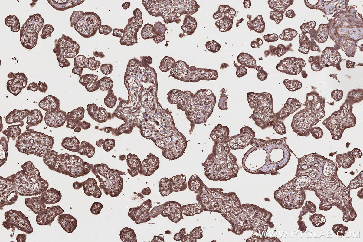 Immunohistochemistry (IHC) staining of human placenta tissue using SCP3 Polyclonal antibody (23024-1-AP)