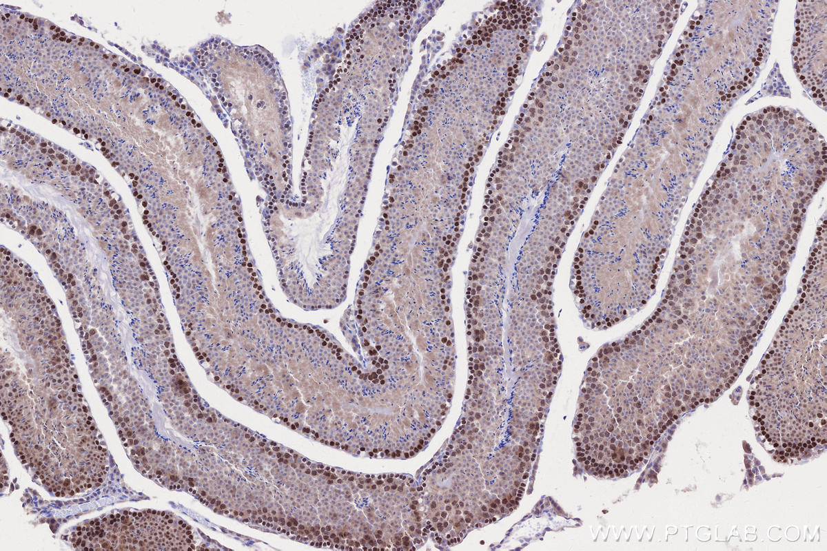 Immunohistochemistry (IHC) staining of mouse testis tissue using SYCP3 Polyclonal antibody (30079-1-AP)