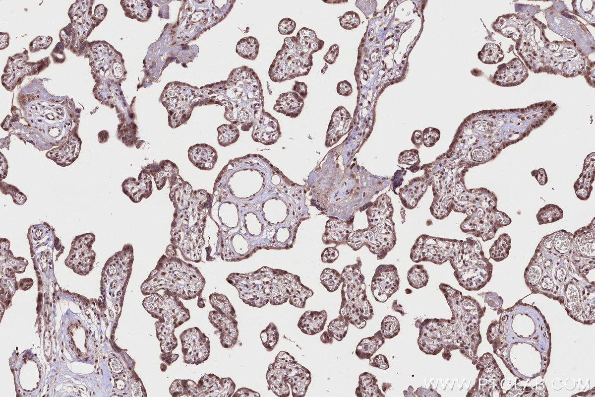 Immunohistochemistry (IHC) staining of human placenta tissue using SYCP3 Polyclonal antibody (30079-1-AP)