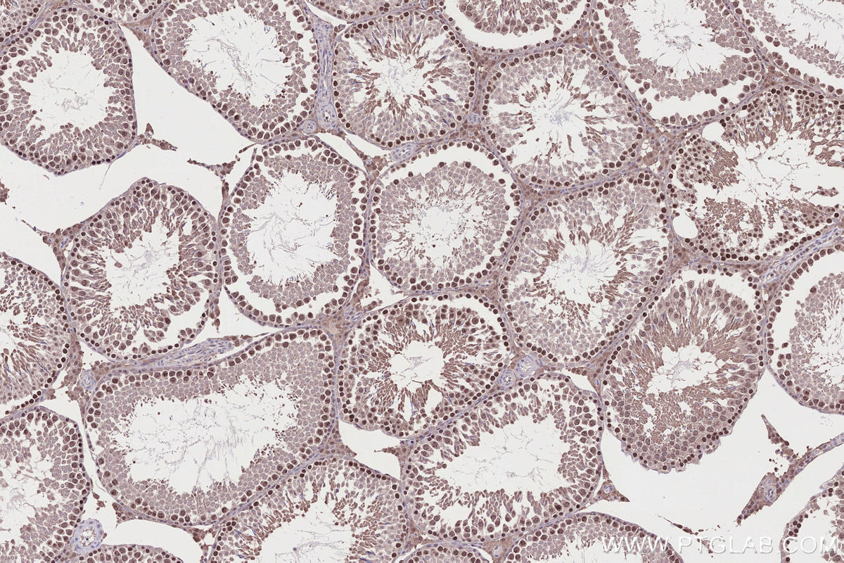 Immunohistochemistry (IHC) staining of rat testis tissue using SYCP3 Polyclonal antibody (30079-1-AP)