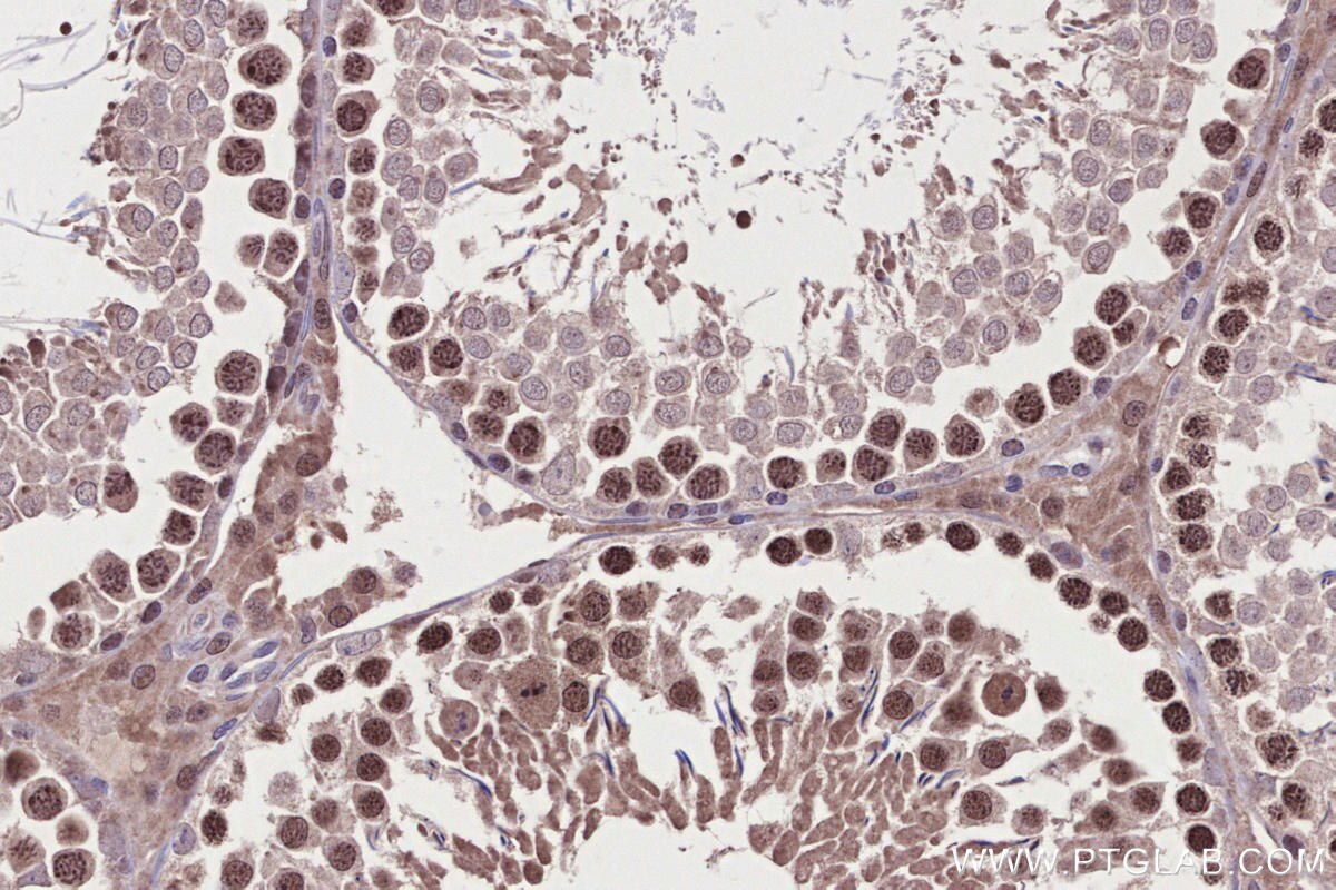 Immunohistochemistry (IHC) staining of rat testis tissue using SYCP3 Polyclonal antibody (30079-1-AP)
