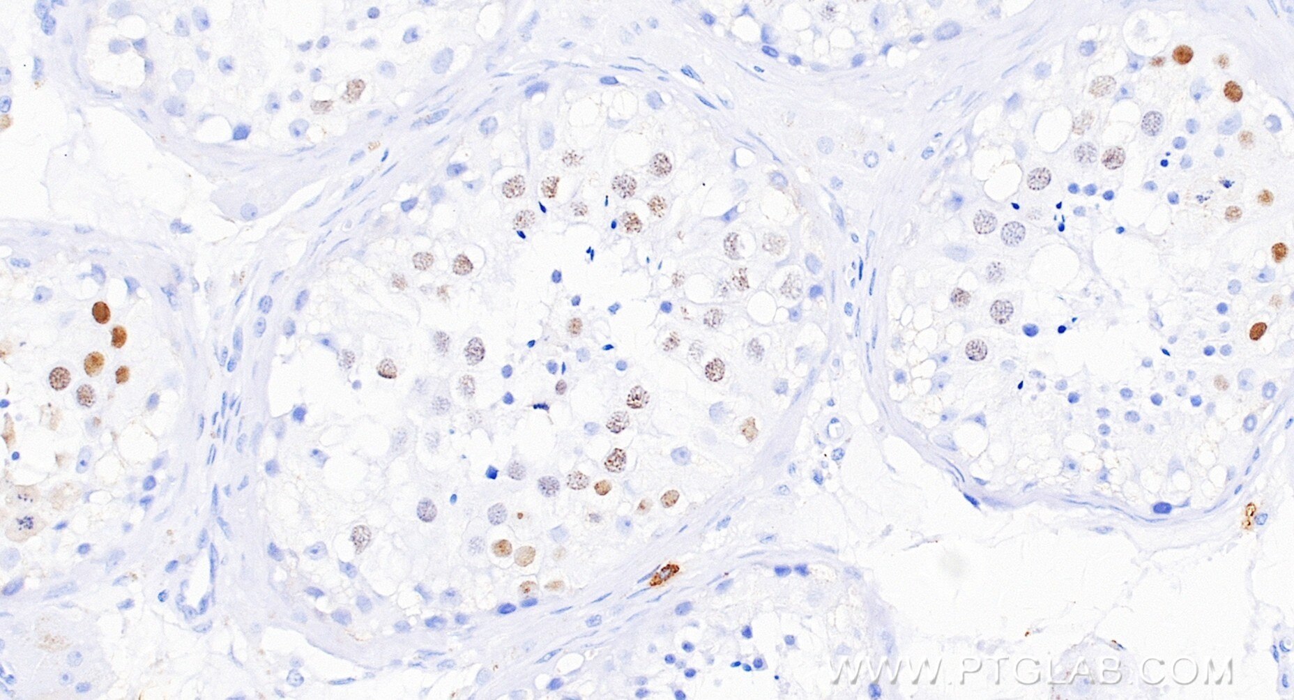 IHC staining of human testis using 86648-2-RR Immunohistochemistry (IHC) staining of human testis tissue using SYCP3 Recombinant monoclonal antibody (86648-2-RR)