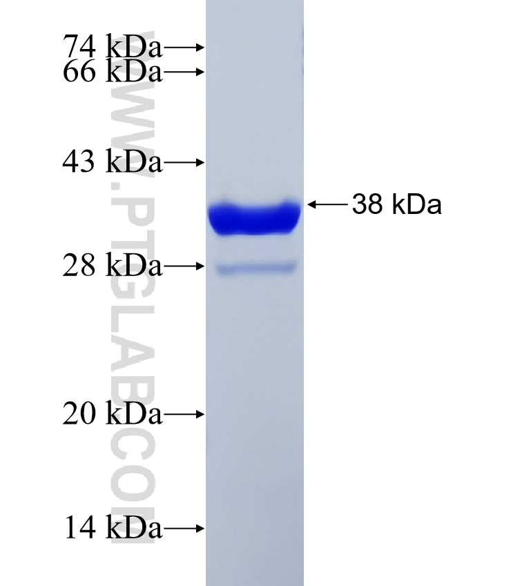 SYCP3 fusion protein Ag32466 SDS-PAGE