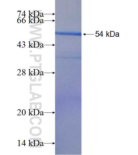 SYCP3 fusion protein Ag19330 SDS-PAGE