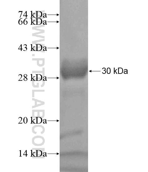 SYCP3 fusion protein Ag19366 SDS-PAGE