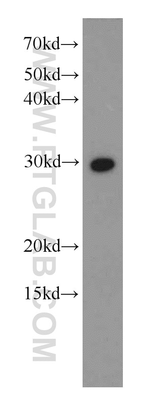 Western Blot (WB) analysis of HEK-293 cells using SYF2 Polyclonal antibody (16958-1-AP)