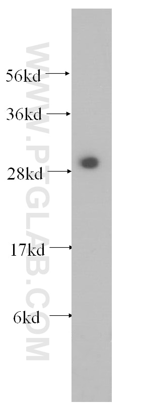 Western Blot (WB) analysis of HEK-293 cells using SYF2 Polyclonal antibody (16958-1-AP)