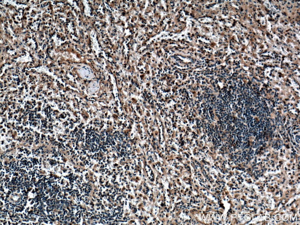 Immunohistochemistry (IHC) staining of human spleen tissue using SYK Polyclonal antibody (14858-1-AP)