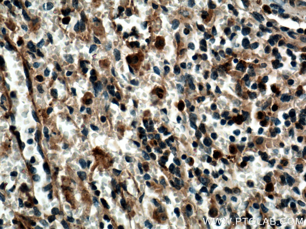 Immunohistochemistry (IHC) staining of human spleen tissue using SYK Polyclonal antibody (14858-1-AP)