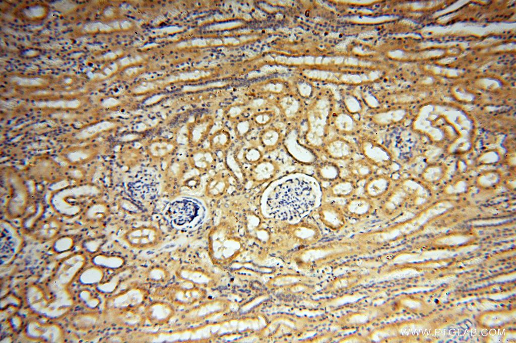 Immunohistochemistry (IHC) staining of human kidney tissue using SYK Polyclonal antibody (14858-1-AP)