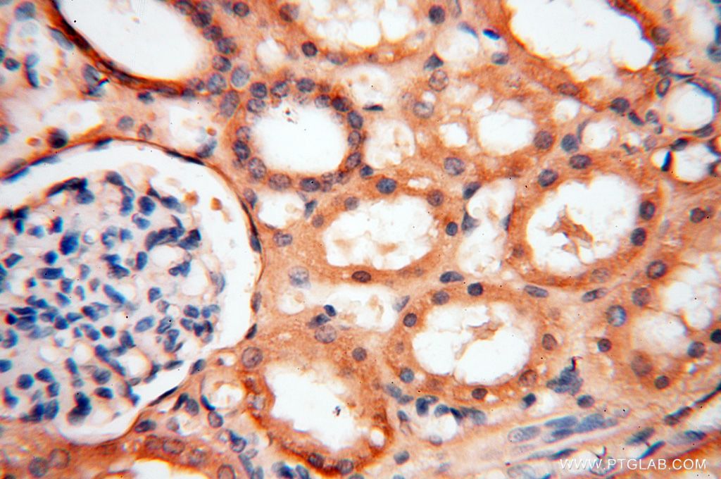 Immunohistochemistry (IHC) staining of human kidney tissue using SYK Polyclonal antibody (14858-1-AP)