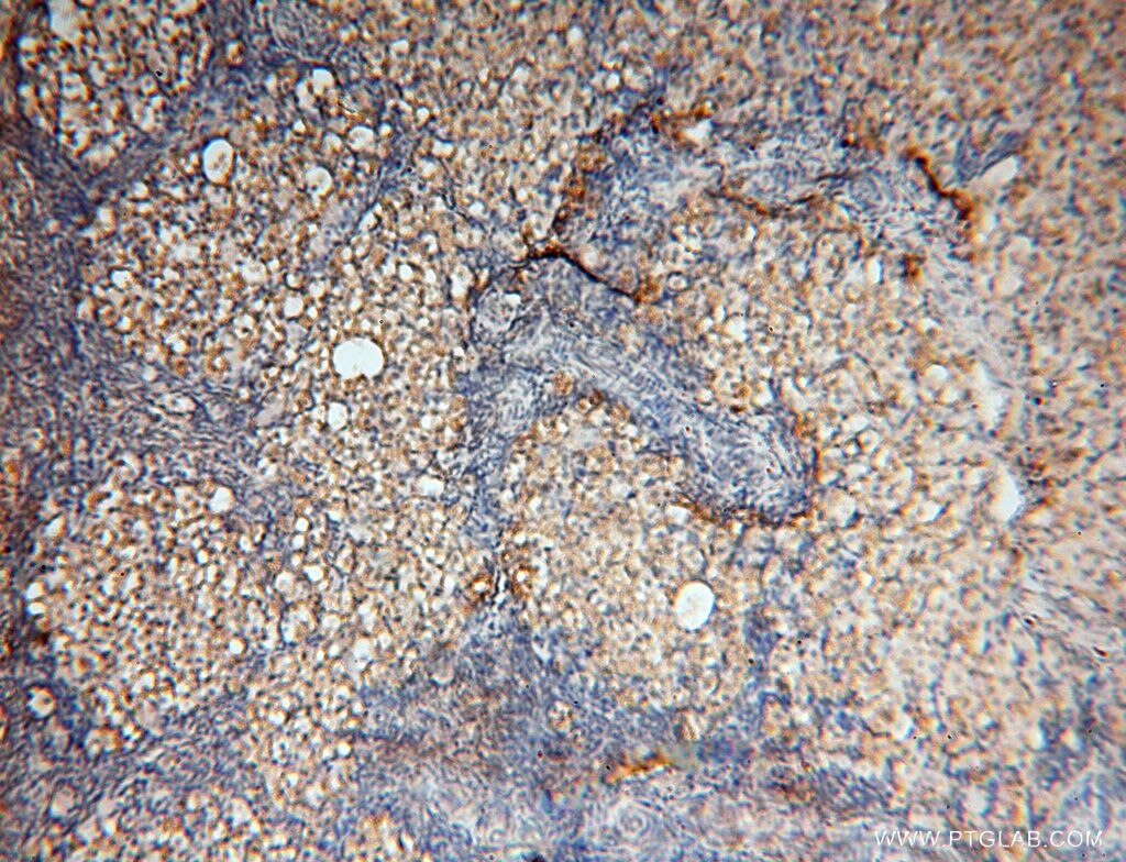 Immunohistochemistry (IHC) staining of human ovary tissue using SYK Polyclonal antibody (14858-1-AP)