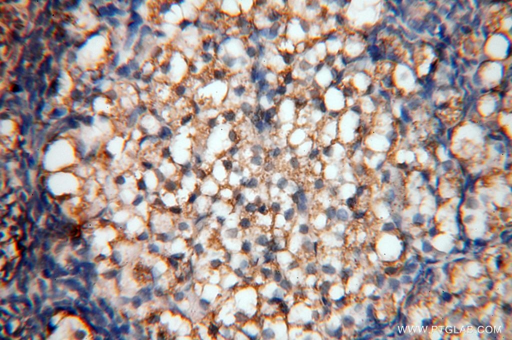 Immunohistochemistry (IHC) staining of human ovary tissue using SYK Polyclonal antibody (14858-1-AP)