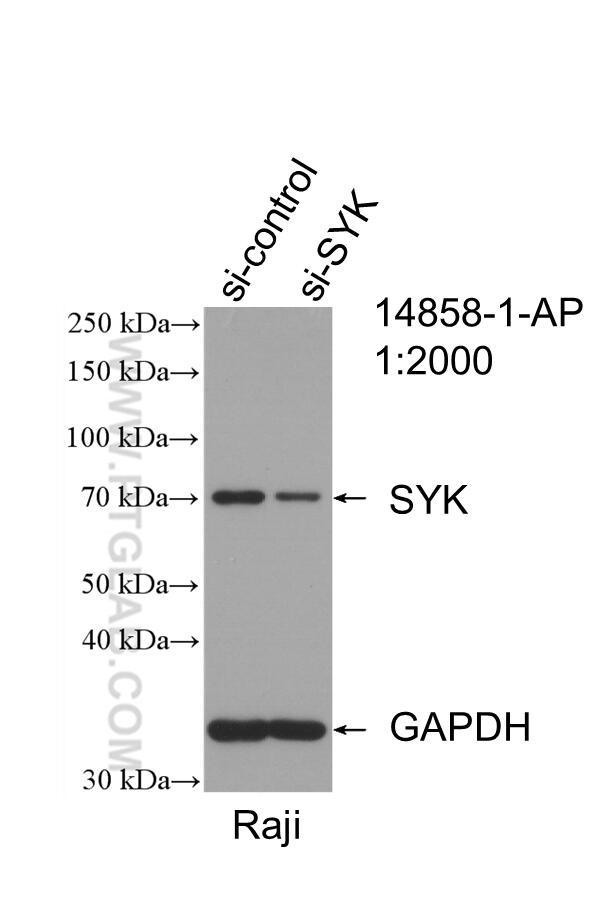 Western Blot (WB) analysis of Raji cells using SYK Polyclonal antibody (14858-1-AP)
