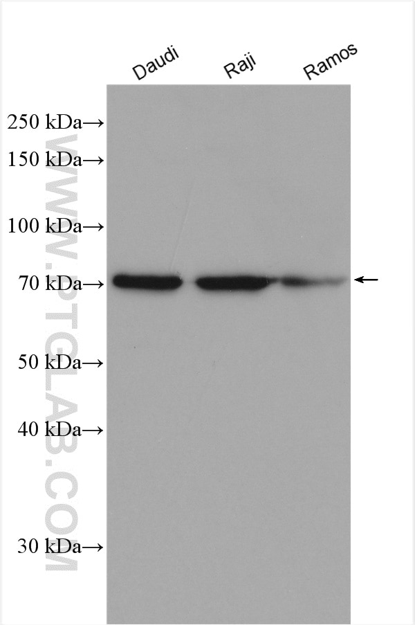 Western Blot (WB) analysis of various lysates using SYK Polyclonal antibody (14858-1-AP)