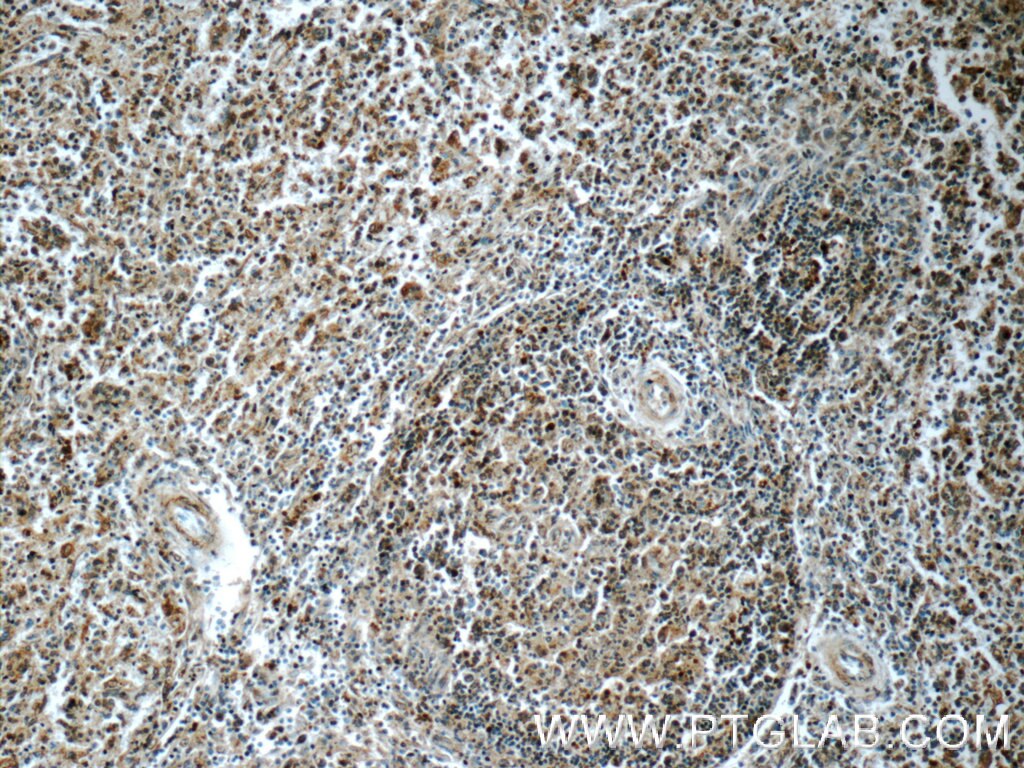 Immunohistochemistry (IHC) staining of human spleen tissue using SYK Polyclonal antibody (22206-1-AP)