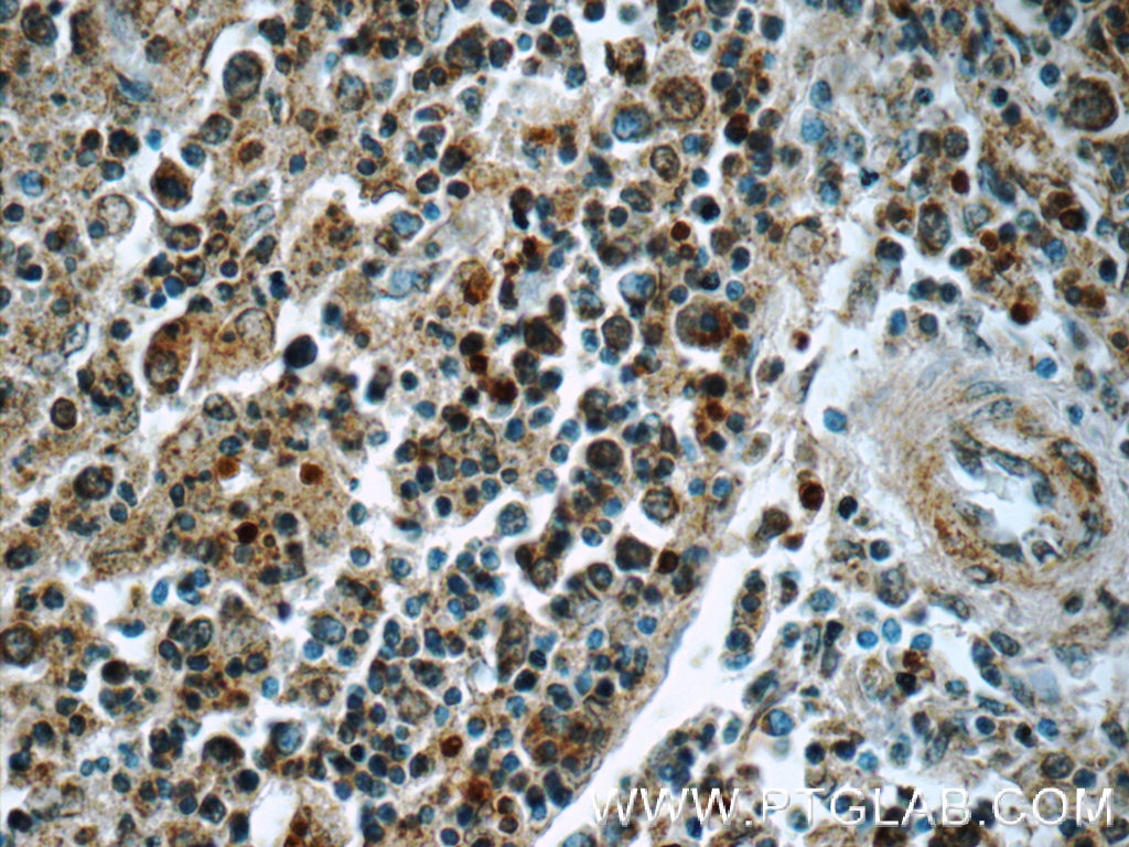 IHC staining of human spleen using 22206-1-AP