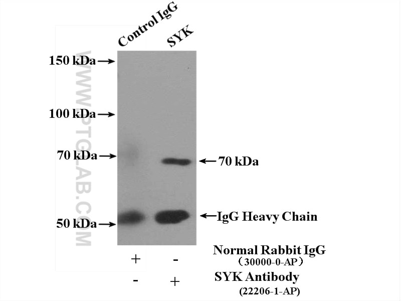 Immunoprecipitation (IP) experiment of HEK-293 cells using SYK Polyclonal antibody (22206-1-AP)