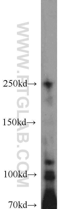 Western Blot (WB) analysis of HEK-293 cells using SYK Polyclonal antibody (22206-1-AP)