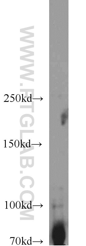 Western Blot (WB) analysis of HEK-293 cells using SYK Polyclonal antibody (22206-1-AP)