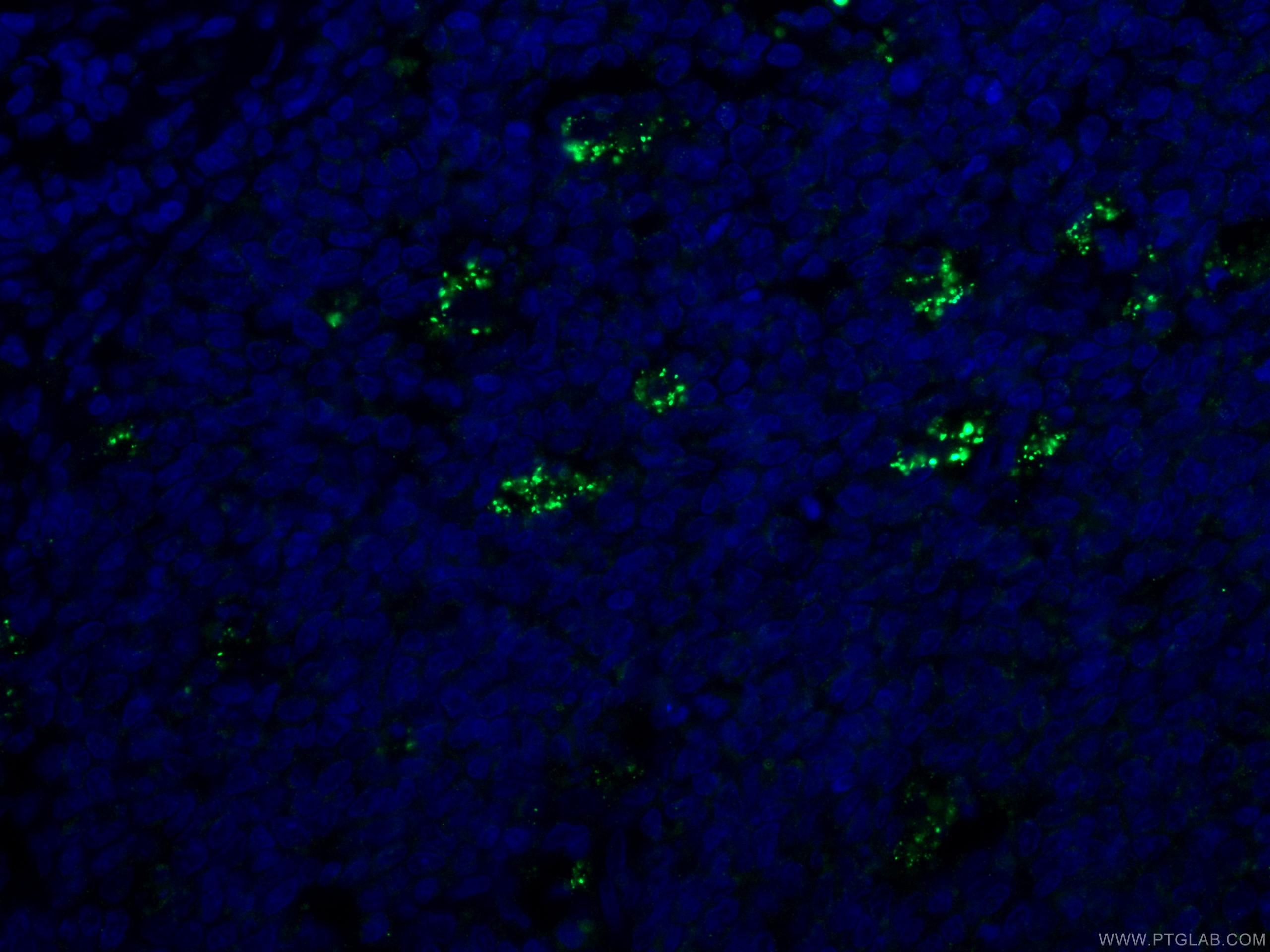 Immunofluorescence (IF) / fluorescent staining of human tonsillitis tissue using SYK Monoclonal antibody (66721-1-Ig)