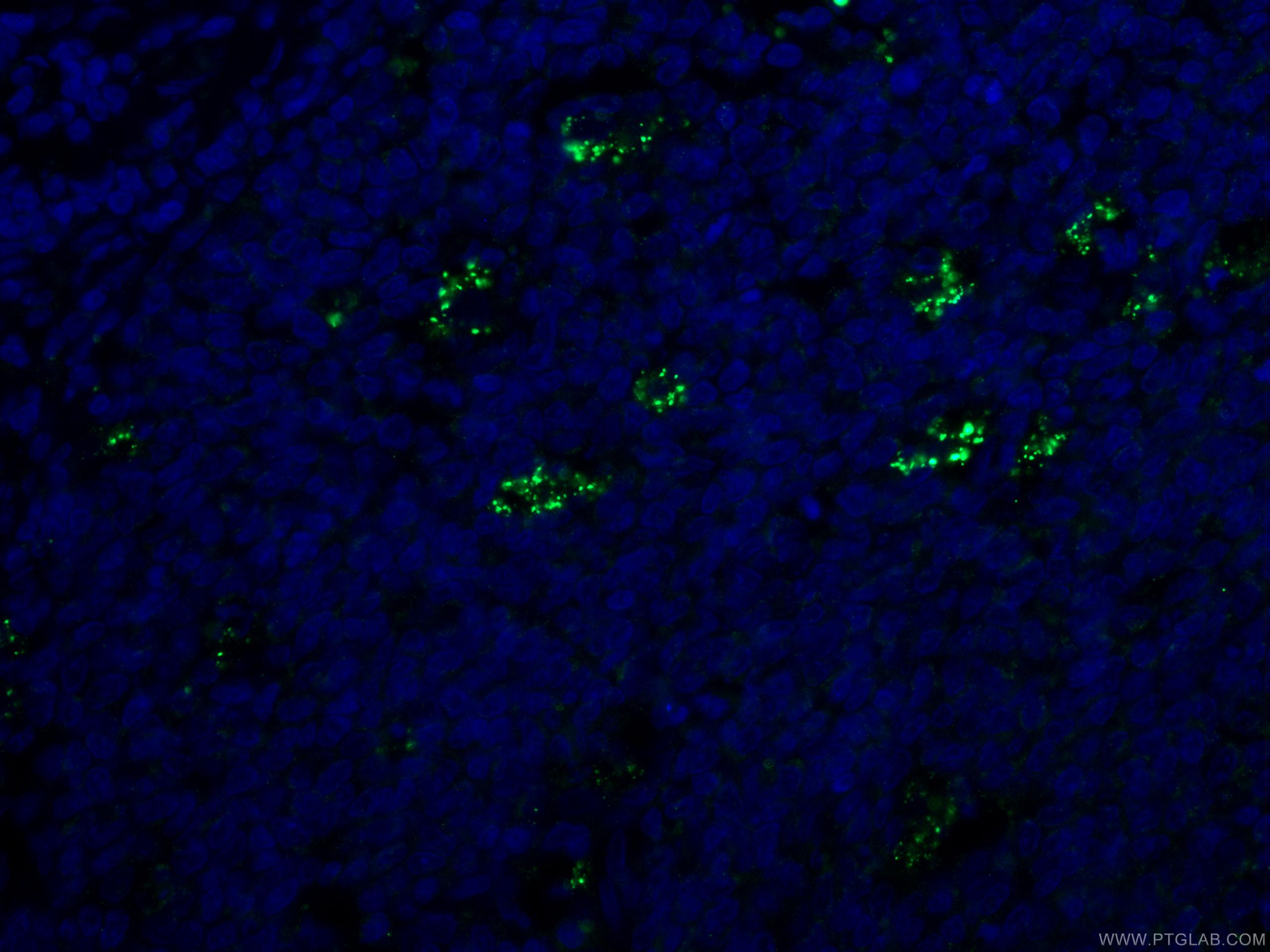 IF Staining of human tonsillitis using 66721-1-Ig